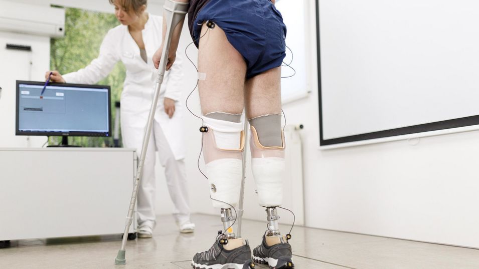 Patient-mit-zwei-Beinprothesen-im-Biomechaniklabor